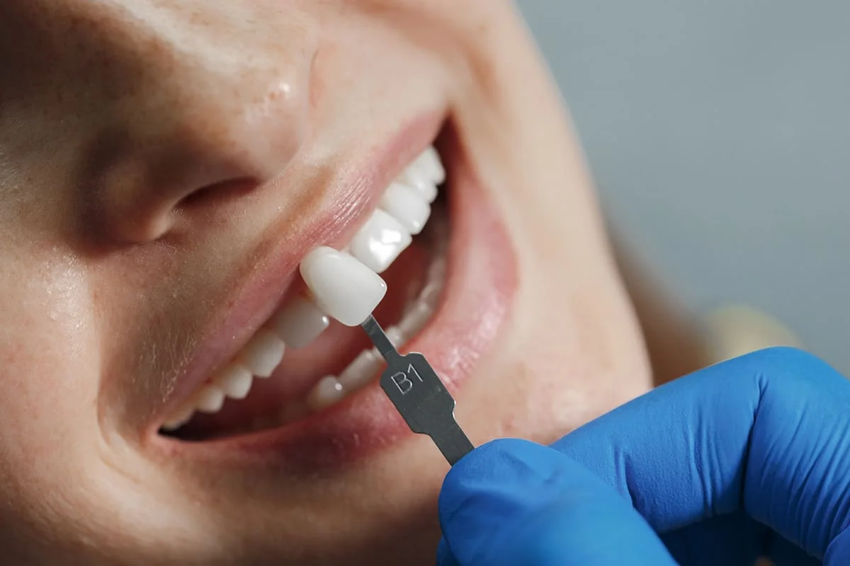 Best Cosmetic Dentistry in Salt Lake