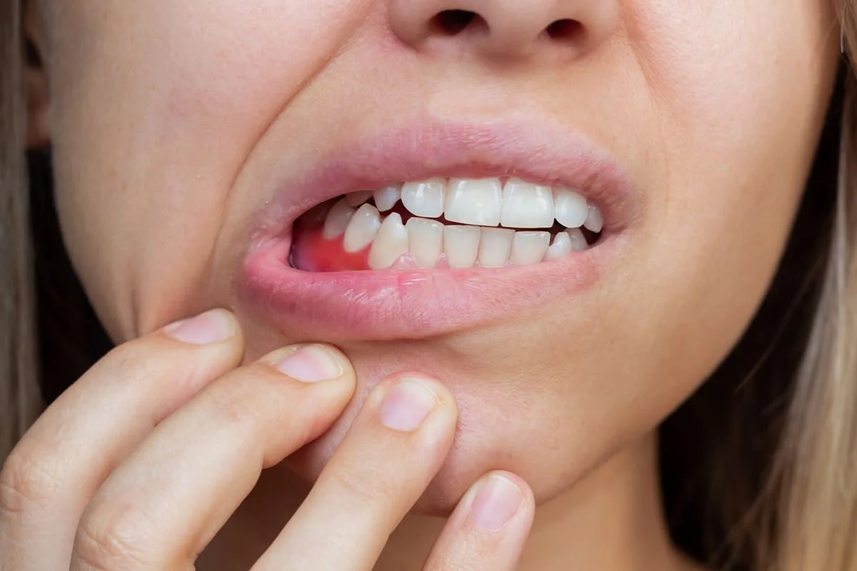 Best Gum Treatment in Salt Lake