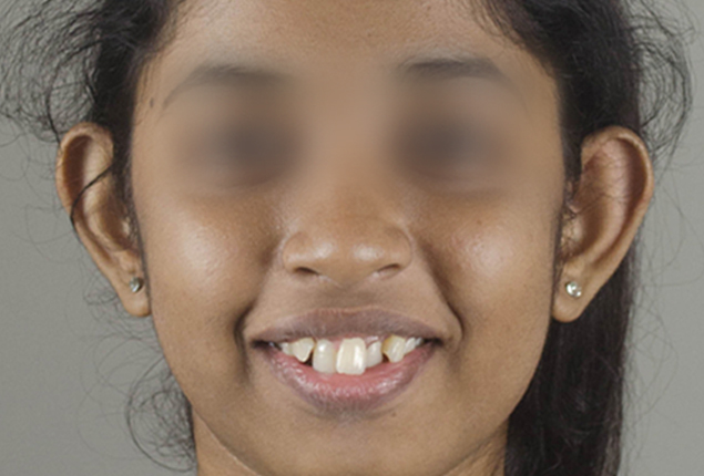 before after 2 before after 2