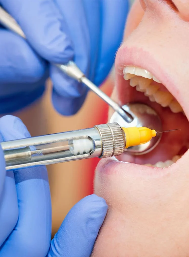 Best Root Canal Therapy in Salt Lake