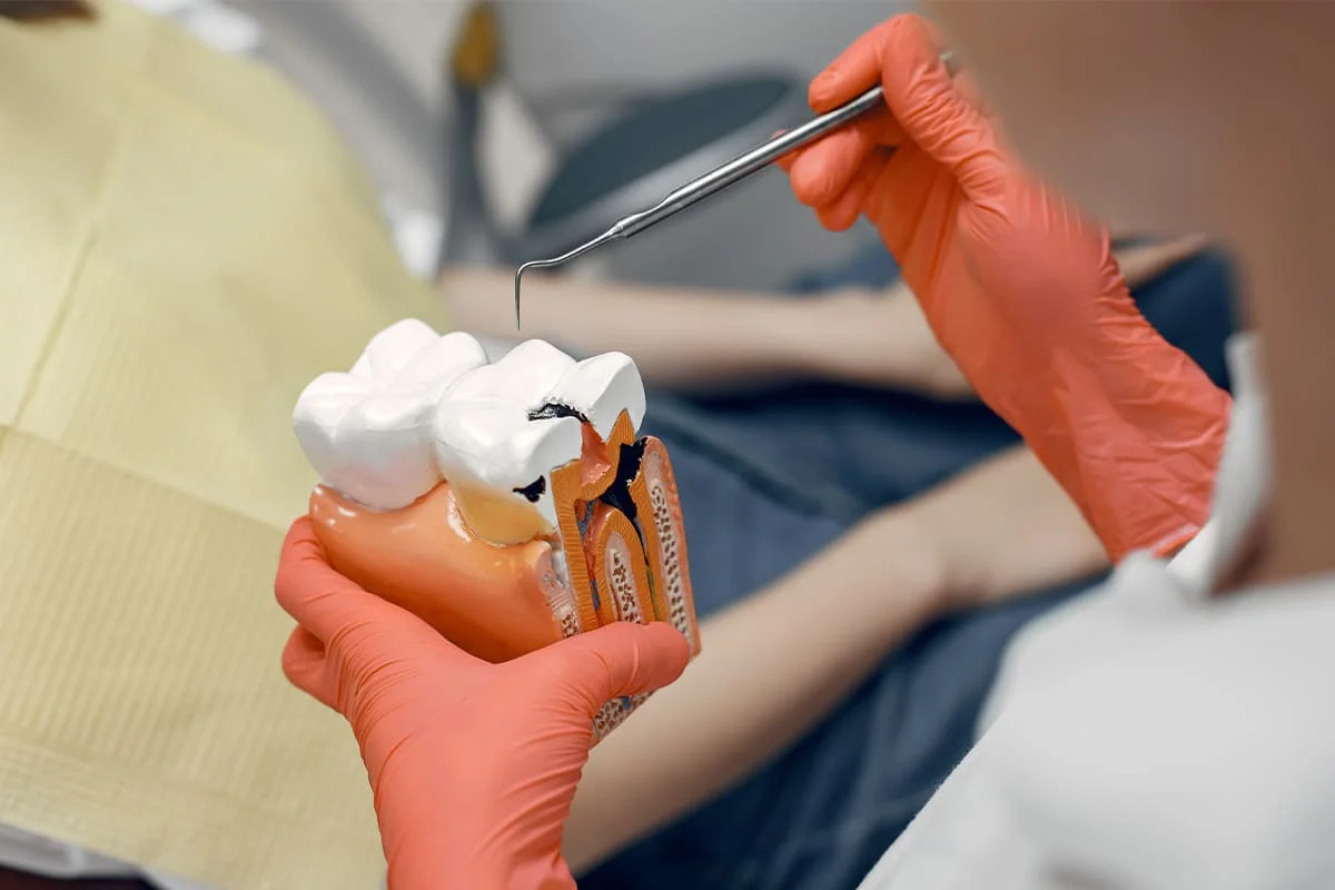 Best Root Canal Therapy in Salt Lake